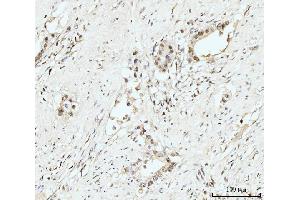 IHC analysis of Nucleostemin/GNL3 using anti-Nucleostemin/GNL3 antibody (ABIN7601778). (Nucleostemin Antikörper  (AA 45-549))