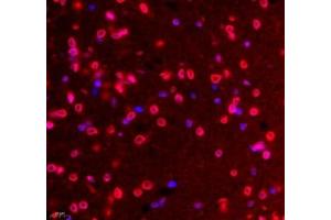 Immunofluorescence of paraffin embedded rat hippocampus using Tuba3a (ABIN7076051) at dilution of 1: 600 (400x lens (Tuba3a Antikörper)