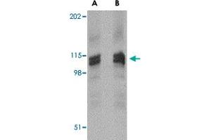 Western blot analysis of DLGAP3 in rat brain tissue lysate with DLGAP3 polyclonal antibody  at (A) 1 (B) 2 ug/mL .