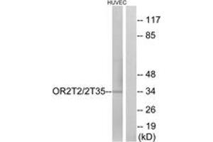 Western blot analysis of extracts from HuvEc cells, using OR2T2/2T35 Antibody. (OR2T2/2T35 Antikörper  (AA 201-250))