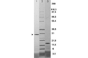 IL-17F Rat Recombinant Protein - SDS-PAGE. (IL17F Protein)
