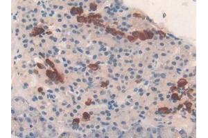 Detection of TUBd in Mouse Pancreas Tissue using Polyclonal Antibody to Tubulin Delta (TUBd) (TUBD1 Antikörper  (AA 236-455))