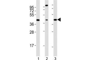 Western blot testing of Sox17 antibody at 1:2000 dilution. (SOX17 Antikörper  (AA 350-400))