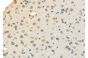 ABIN6263506 and ABIN6273143 at 1/100 staining Rat brain tissue by IHC-P. (SSNA1 Antikörper  (N-Term))