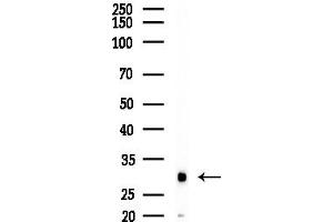 Western blot analysis of lysates from Mouse liver, using CTDSP1 Antibody at 1/1000 dilution.