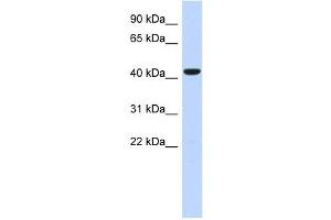 SGMS2 antibody used at 1 ug/ml to detect target protein. (Sphingomyelin Synthase 2 Antikörper  (N-Term))