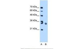 Image no. 1 for anti-X-Box Binding Protein 1 (XBP1) (C-Term) antibody (ABIN6737841) (XBP1 Antikörper  (C-Term))