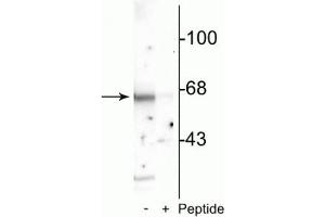 Western blot of rat cortical lysate showing specific immunolabeling of the ~65 kDa Munc-18 protein phosphorylated at Ser513 in the first lane (-). (STXBP2 Antikörper  (pSer513))
