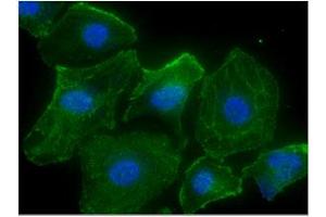 ICC/IF analysis of CASQ2 in HeLa cells line, stained with DAPI (Blue) for nucleus staining and monoclonal anti-human CASQ2 antibody (1:100) with goat anti-mouse IgG-Alexa fluor 488 conjugate (Green). (CASQ2 Antikörper  (AA 20-399))