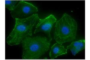 ICC/IF analysis of CASQ2 in HeLa cells line, stained with DAPI (Blue) for nucleus staining and monoclonal anti-human CASQ2 antibody (1:100) with goat anti-mouse IgG-Alexa fluor 488 conjugate (Green). (CASQ2 Antikörper)