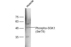 Mouse muscle lysates probed with Rabbit Anti-SGK1 (Ser78) Polyclonal Antibody, Unconjugated  at 1:5000 for 90 min at 37˚C. (SGK1 Antikörper  (pSer78))