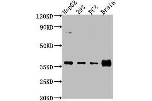Western Blot Positive WB detected in: HepG2 whole cell lysate, 293 whole cell lysate, PC3 whole cell lysate, Rat brain tissue All lanes: RFNG antibody at 1:2000 Secondary Goat polyclonal to rabbit IgG at 1/50000 dilution Predicted band size: 37 kDa Observed band size: 37 kDa (RFNG Antikörper  (AA 71-331))