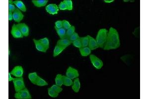 Immunofluorescence staining of Hela cells with ABIN7157400 at 1:100, counter-stained with DAPI. (Keratin 2 Antikörper  (AA 207-424))