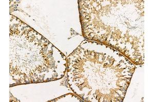 ABIN6259936 and ABIN6266756 at 1/100 staining Rat testis tissue by IHC-P.
