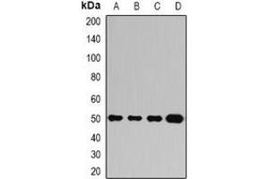 Western blot analysis of Ataxin 3 expression in Jurkat (A), A549 (B), mouse brain (C), mouse liver (D) whole cell lysates. (Ataxin 3 Antikörper)
