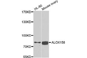Western blot analysis of extracts of various cell lines, using ALOX15B antibody. (ALOX15B Antikörper)