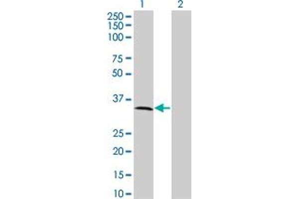 MPPED2 Antikörper  (AA 1-294)