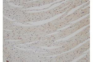 ABIN6275541 at 1/100 staining Mouse heart tissue by IHC-P.