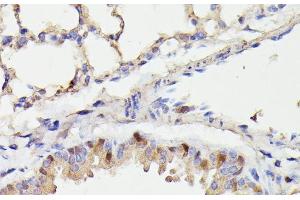 Immunohistochemistry of paraffin-embedded Mouse lung using CDC23 Polyclonal Antibody at dilution of 1:100 (40x lens). (CDC23 Antikörper)