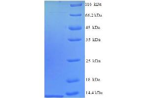 Chemokine (C-C Motif) Ligand 12 (Ccl12) (AA 23-104) protein (His tag)