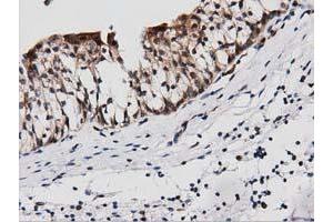 Immunohistochemical staining of paraffin-embedded Human liver tissue using anti-PEPD mouse monoclonal antibody. (PEPD Antikörper)