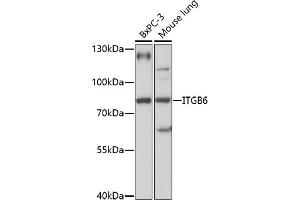 Western blot analysis of extracts of various cell lines, using ITGB6 antibody (ABIN7267932) at 1:1000 dilution. (ITGB6 Antikörper  (AA 732-788))
