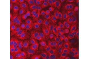 IF analysis of SEC23IP using anti-SEC23IP antibody (ABIN7601222). (SEC23IP Antikörper  (AA 30-426))