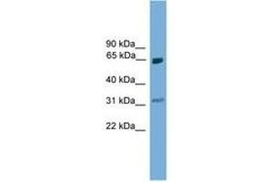Image no. 1 for anti-Protein Inhibitor of Activated STAT, 2 (PIAS2) (AA 81-130) antibody (ABIN6744670) (PIAS2 Antikörper  (AA 81-130))