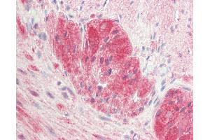 Anti-RET antibody IHC staining of human small intestine, myenteric plecus.