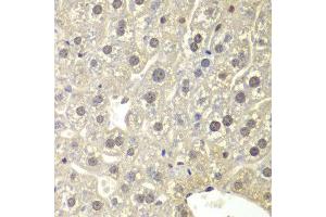 Immunohistochemistry (IHC) image for anti-Nuclear Receptor Subfamily 3, Group C, Member 1 (Glucocorticoid Receptor) (NR3C1) (AA 1-280) antibody (ABIN3023091) (Glucocorticoid Receptor Antikörper  (AA 1-280))