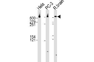 Western blot analysis of lysates from Hela, PC-3 cell line and rat brain tissue lysate(from left to right), using DYNC1H1 Antibody (C-term) (ABIN6242986 and ABIN6577559). (DYNC1H1 Antikörper  (C-Term))