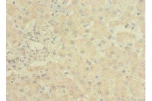 Immunohistochemistry of paraffin-embedded human liver tissue using ABIN7158162 at dilution of 1:100 (LRRC31 Antikörper  (AA 1-300))