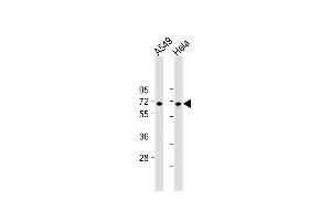 All lanes : Anti-FOXN1 Antibody (Center) at 1:2000 dilution Lane 1: A549 whole cell lysate Lane 2: Hela whole cell lysate Lysates/proteins at 20 μg per lane.