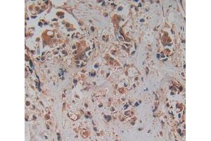 Immunohistochemistry (IHC) image for anti-Prolylcarboxypeptidase (PRCP) (AA 108-376) antibody (ABIN1869926)
