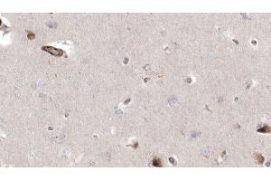 ABIN6272940 at 1/100 staining Human brain cancer tissue by IHC-P. (CISD2 Antikörper  (Internal Region))