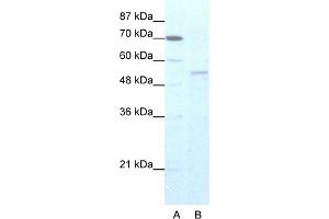 WB Suggested Anti-ZNF665 Antibody Titration:  5. (ZNF665 Antikörper  (N-Term))