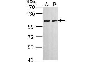 WB Image Sample (30 ug of whole cell lysate) A: H1299 B: Hela 7. (HGS Antikörper  (C-Term))