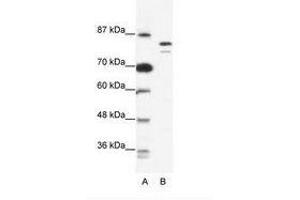 Image no. 1 for anti-Minichromosome Maintenance Deficient 8 (MCM8) (AA 144-193) antibody (ABIN203257) (MCM8 Antikörper  (AA 144-193))