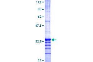 Image no. 1 for TMEM189-UBE2V1 Readthrough (TMEM189-UBE2V1) (AA 94-164) protein (GST tag) (ABIN1322999)