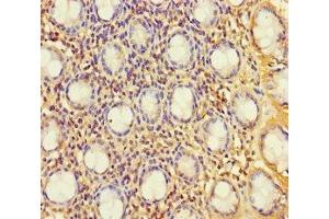 Immunohistochemistry of paraffin-embedded human colon tissue using ABIN7174792 at dilution of 1:100 (C1ORF53 Antikörper  (AA 1-145))