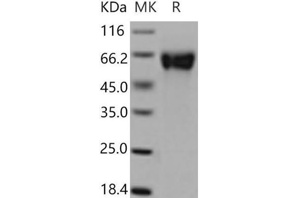 GFRA1 Protein (His tag)