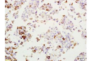 Immunohistochemistry (Paraffin-embedded Sections) (IHC (p)) image for anti-Melanoma Antigen Family A, 1 (Directs Expression of Antigen MZ2-E) (MAGEA1) (AA 101-200) antibody (ABIN728578)