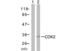 Western blot analysis of the extracts from A2780 cells using CDK2 (Ab-160) antibody (E021111). (CDK2 Antikörper)