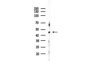 anti-Lymphotoxin beta Receptor (TNFR Superfamily, Member 3) (LTBR) (N-Term) antibody
