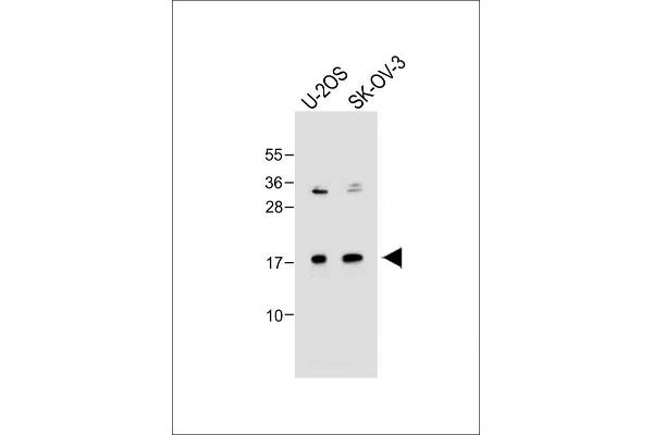 FGF16 antibody  (N-Term)