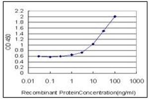 ELISA image for anti-Galactose-1-Phosphate Uridylyltransferase (GALT) antibody (ABIN781864) (GALT Antikörper)