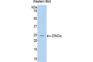 Western blot analysis of the recombinant protein. (IL10RB Antikörper  (AA 42-218))