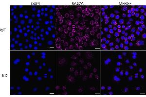 anti-RAB7A, Member RAS Oncogene Family (RAB7A) antibody