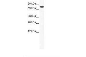 Image no. 1 for anti-Core-binding Factor, Runt Domain, alpha Subunit 2, Translocated To, 2 (CBFA2T2) (AA 357-406) antibody (ABIN6736057)
