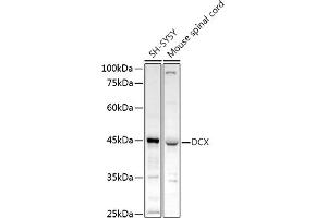 Western blot analysis of extracts of various cell lines, using DCX antibody (ABIN3021509, ABIN3021510, ABIN3021511 and ABIN6215166) at 1:1000 dilution. (Doublecortin Antikörper  (AA 11-360))